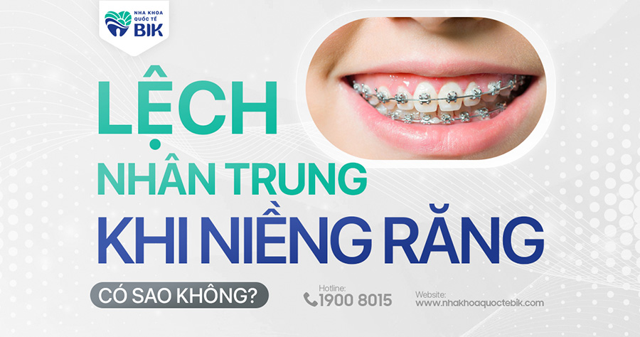 lech-nhan-trung-khi-nieng-rang