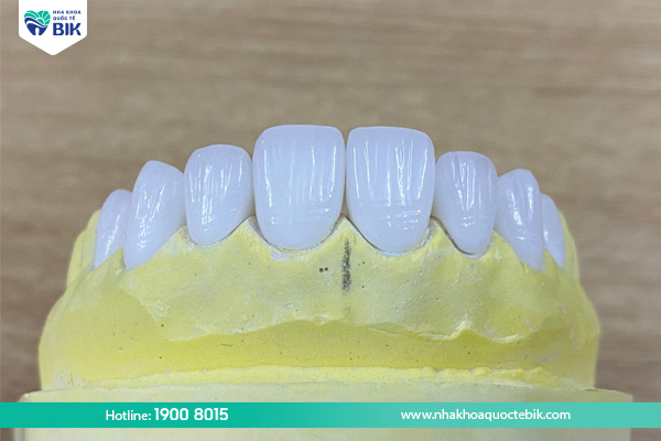 Things to note when covering Zirconia porcelain teeth