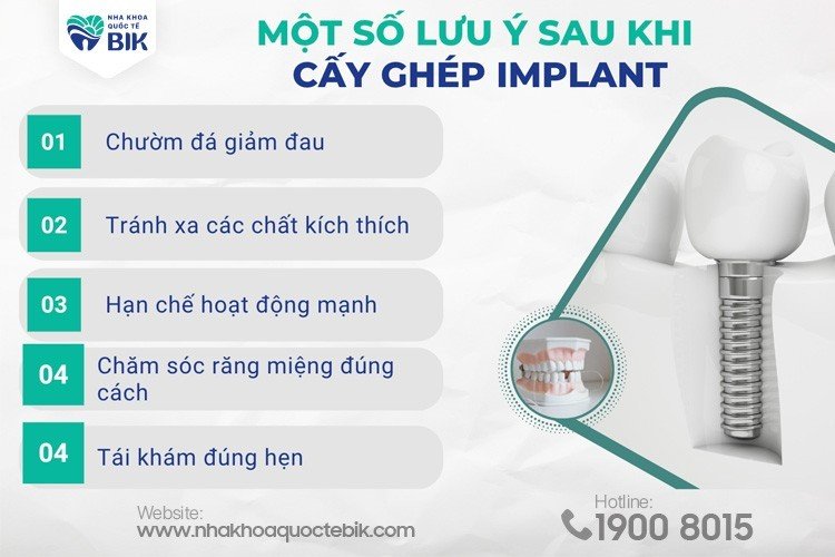 luu-y-quan-trong-sau-khi-cay-ghep-implant