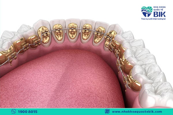 Does Invisalign Braces Hurt?