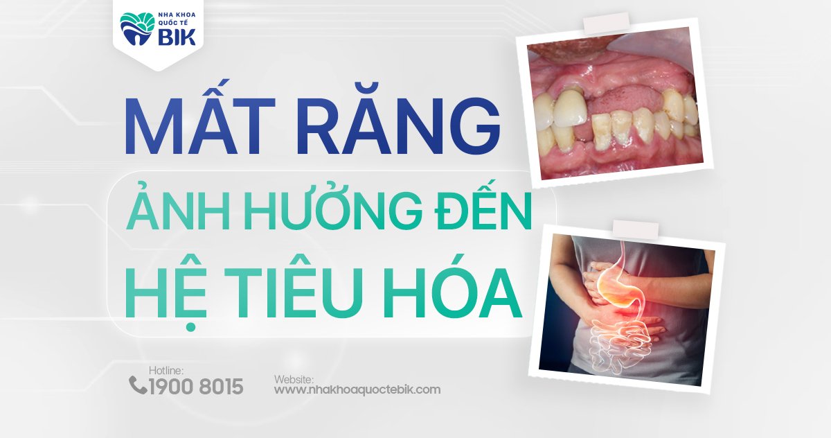 Mất răng ảnh hưởng đến hệ tiêu hoá