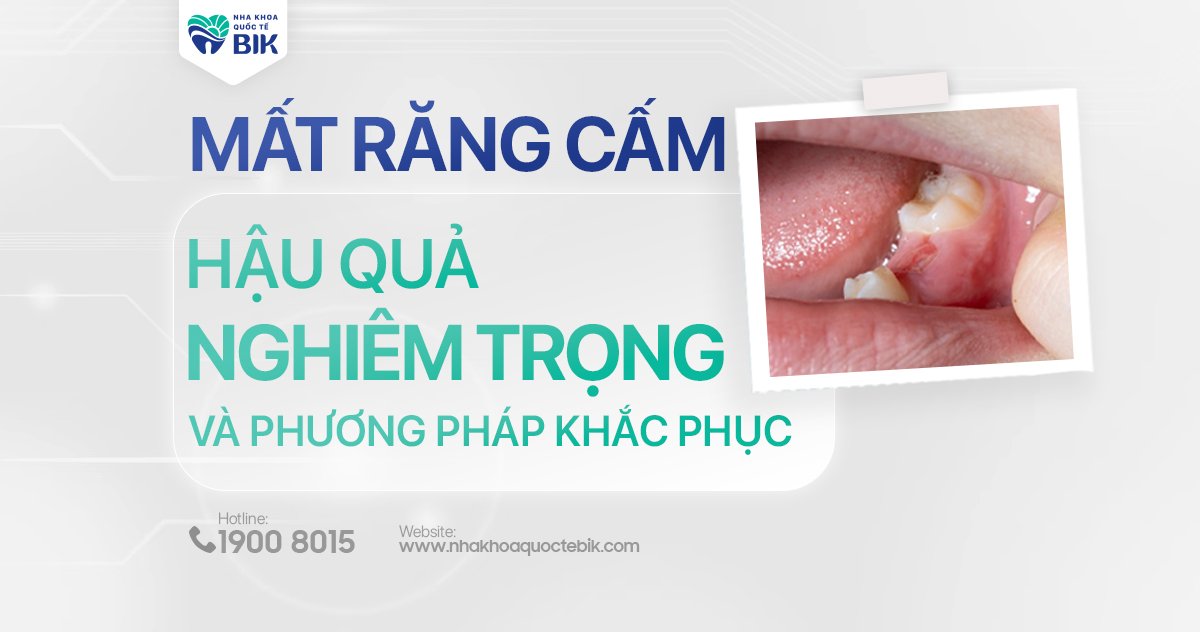 Mất răng cắm có sao không?