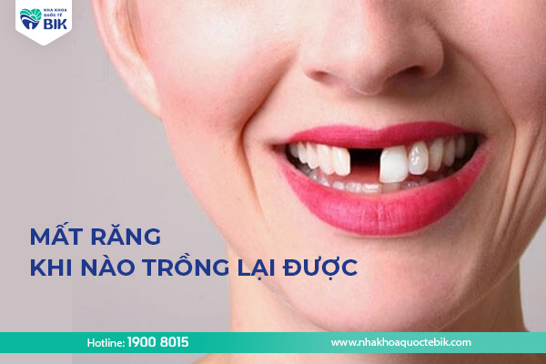 Mất răng khi nào trồng lại được?