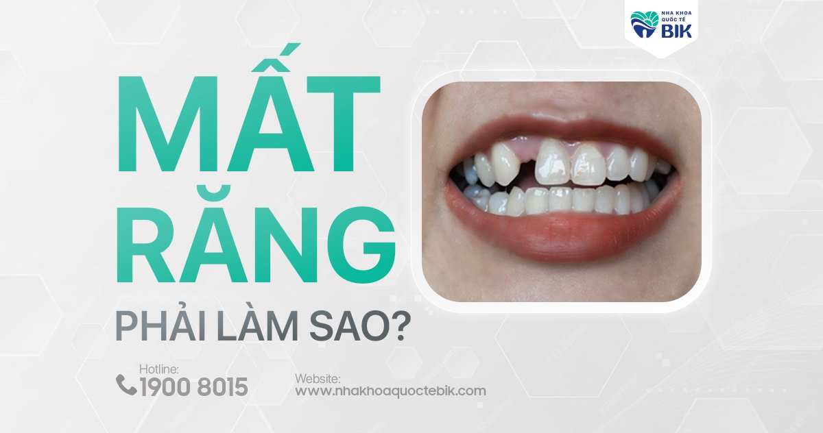 Mất răng phải làm sao?