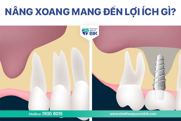 nang-xoang-mang-den-loi-ich-gi