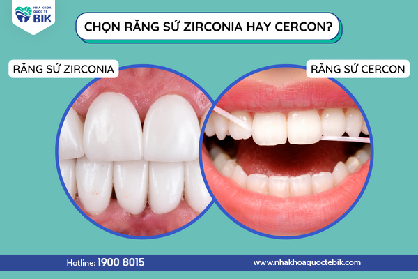 nen-chon-boc-rang-su-zirconia-hay-cercon