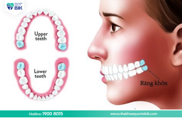 Người trưởng thành có bao nhiêu cái răng?