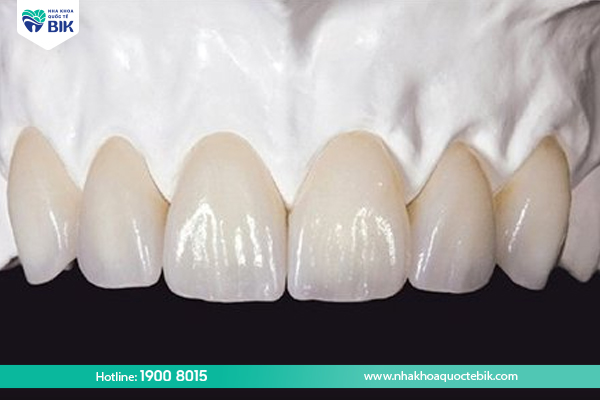 Origin of Zirconia porcelain teeth