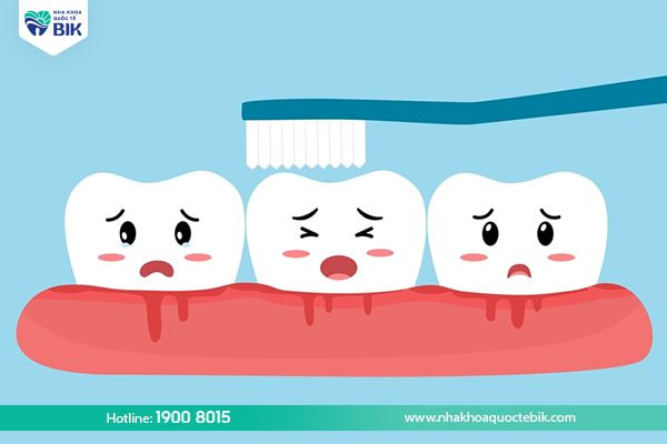 Causes of bleeding gums teeth