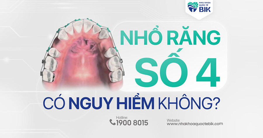 nho-rang-so-4-co-nguy-hiem-khong