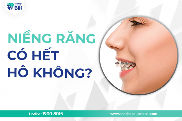 Niềng răng có hết hô không?