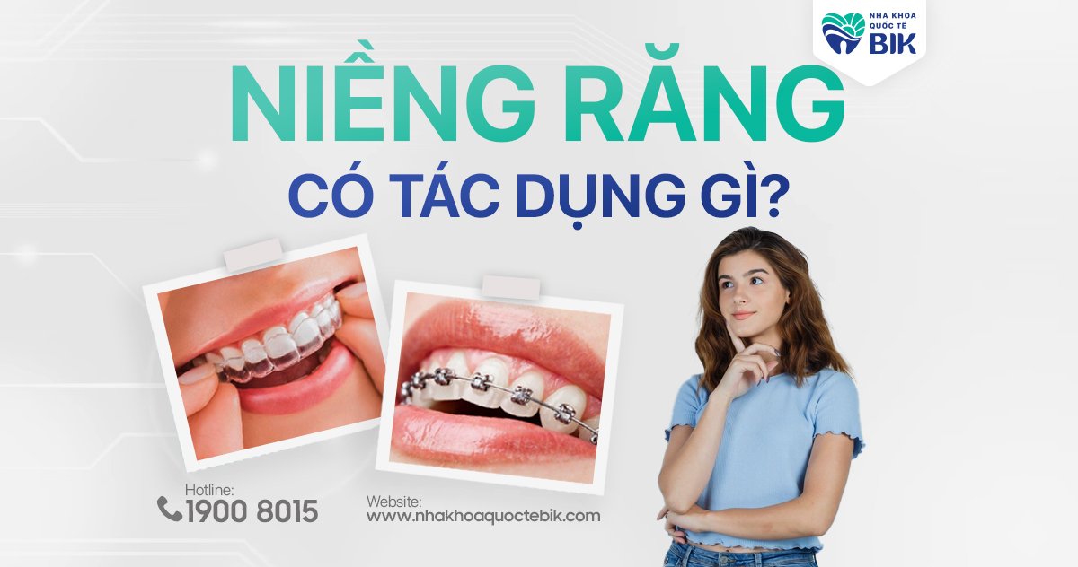 Niềng răng có tác dụng gì?