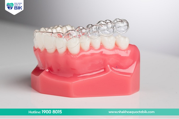 3D Clear Invisible Braces