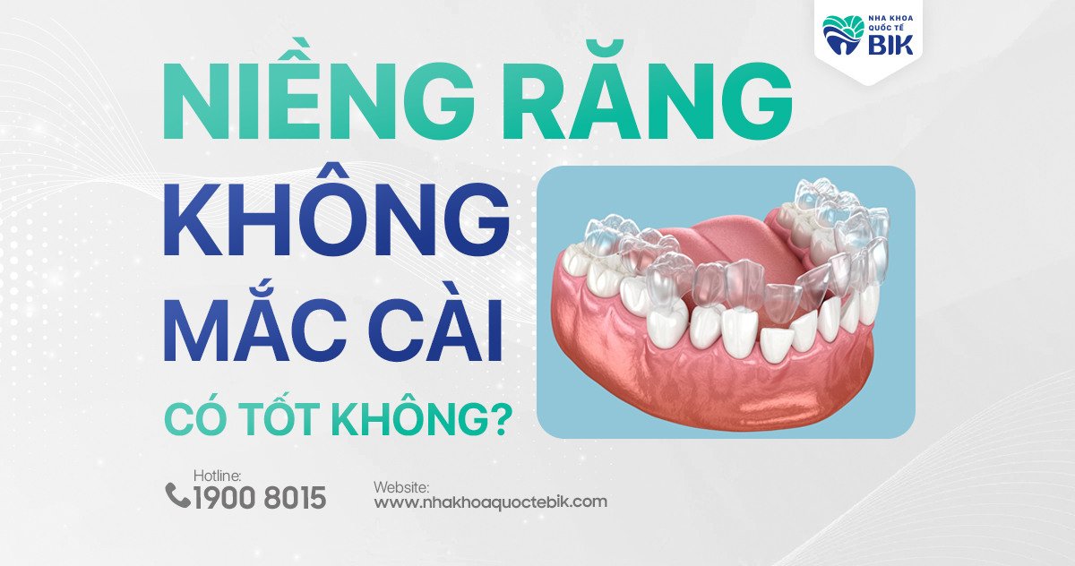 Niềng răng không mắc cài