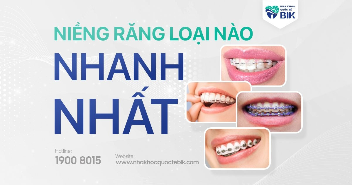 Niềng răng loại nào nhanh nhất