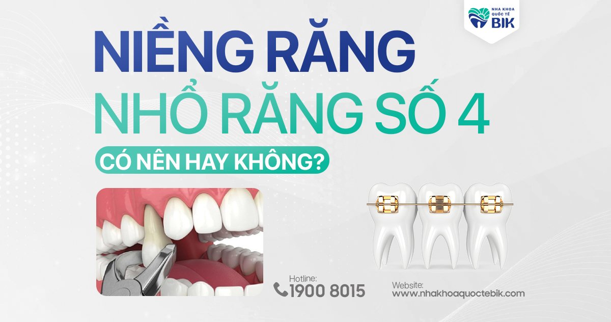 Niềng răng nhổ răng số 4