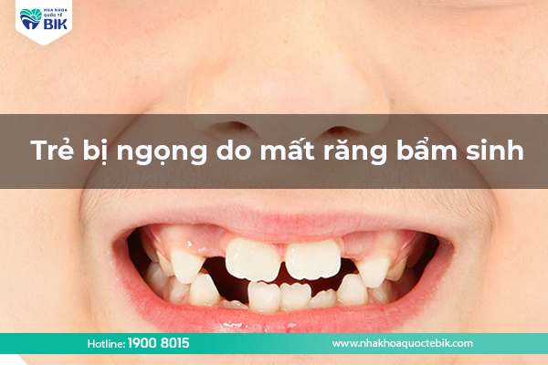 Incorrect pronunciation due to congenital tooth loss