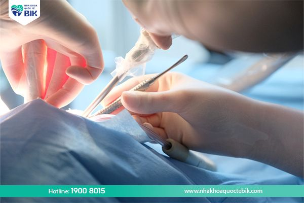 Surgery to treat receding gums