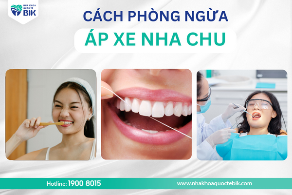 phong-ngua-ap-xe-nha-chu