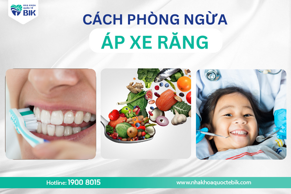 phong-ngua-ap-xe-rang