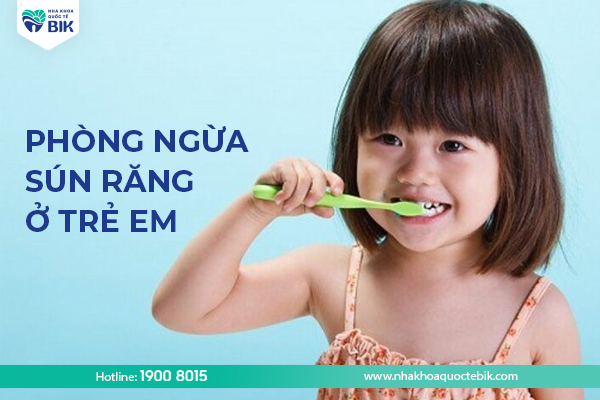 Preventing tooth decay in children