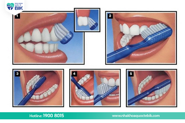 Preventing periodontitis