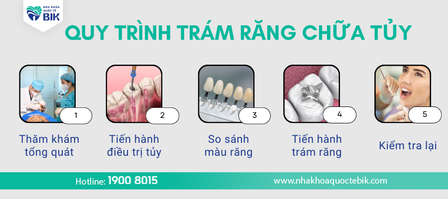 tram-rang-co-can-lay-tuy-khong