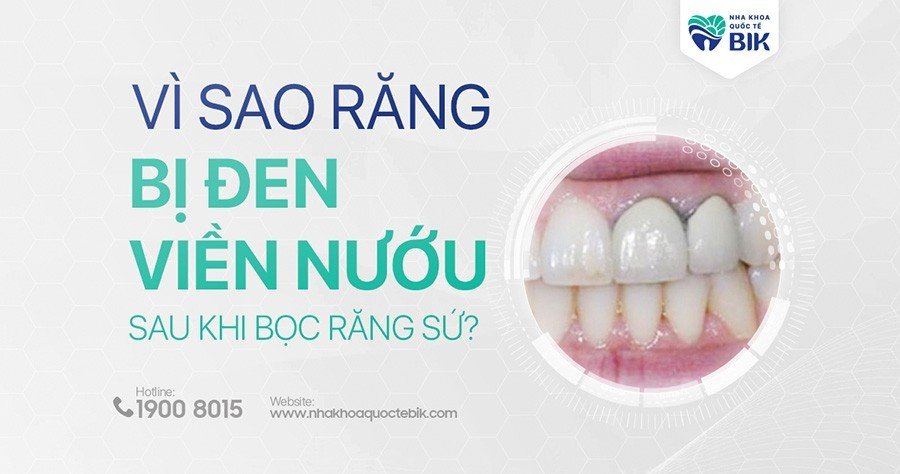 boc-rang-su-bi-den-nuou