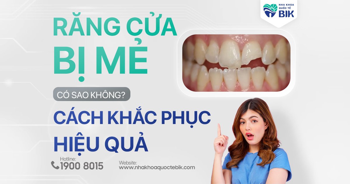 Răng cửa bị mẻ