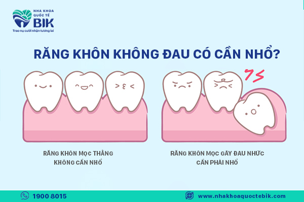 Do wisdom teeth that do not hurt need to be extracted?