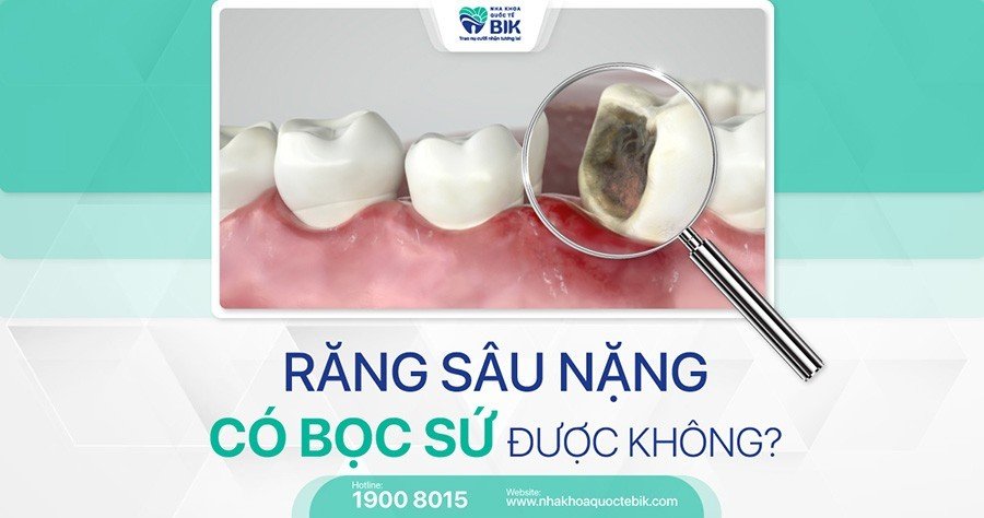 rang-sau-nang-co-boc-su-duoc-khong