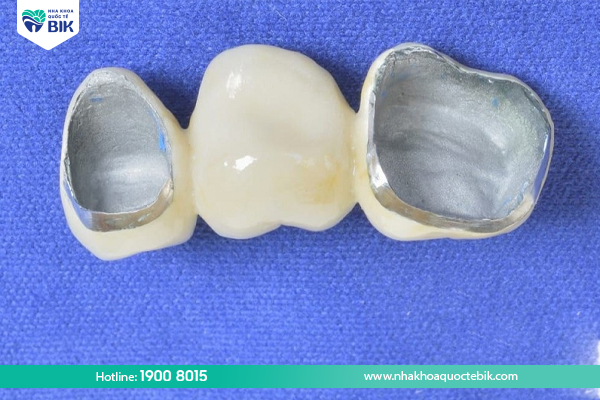 What is Titan porcelain teeth?