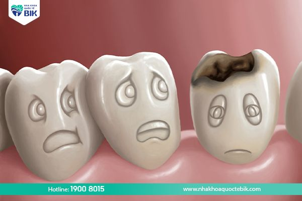 Is wisdom tooth decay dangerous?