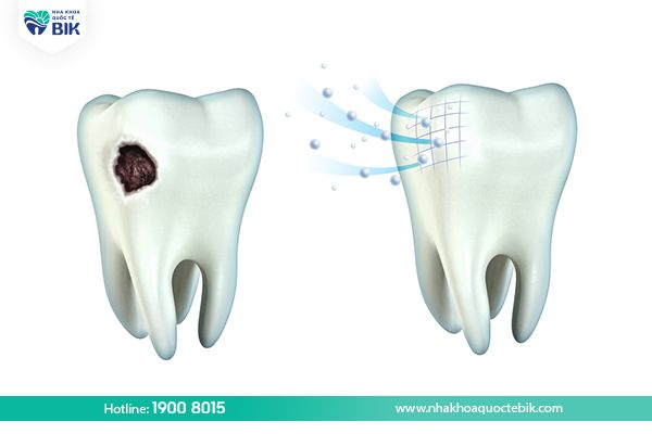 Remineralize tooth enamel