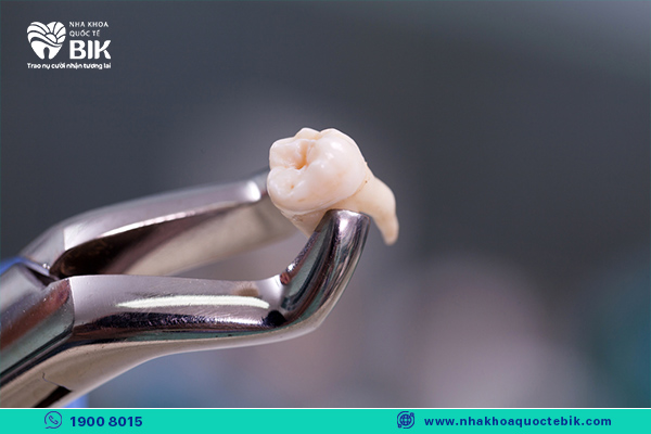 wisdom teeth should only be extracted when you are in good health