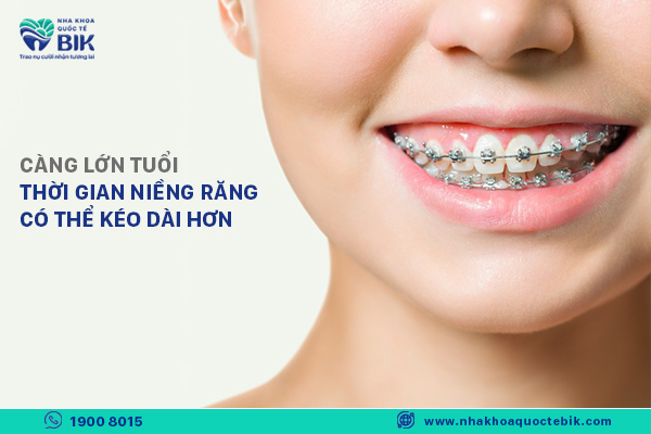 thời gian niềng răng người lớn mắc bao lâu