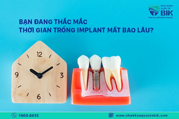 trong-rang-implant-mat-bao-lau