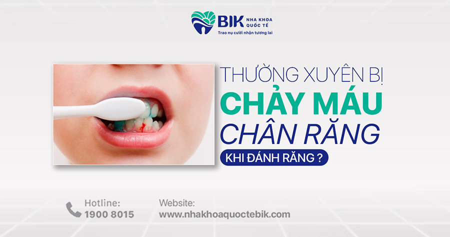 thuong-xuyen-bi-chay-mau-chan-rang-khi-danh-rang