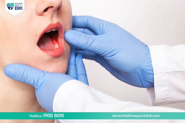 Bleeding from deep teeth