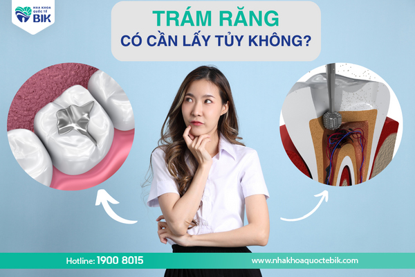 tram-rang-co-can-lay-tuy-khong