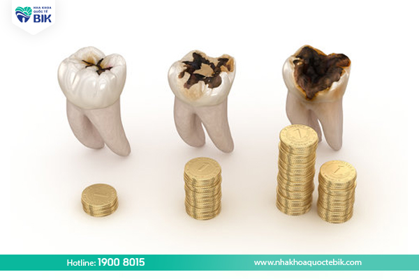 How much does it cost to implant a false tooth?