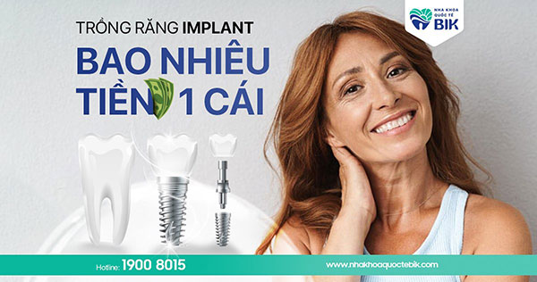 trong-rang-implant-gia-bao-nhieu-1-cai