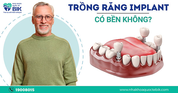 trong-rang-implant-co-ben-khong