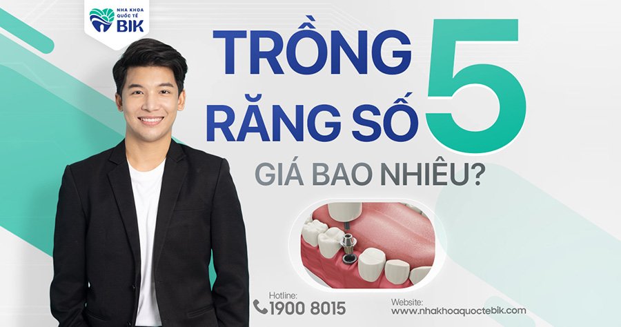 trong-rang-so-5-gia-bao-nhieu