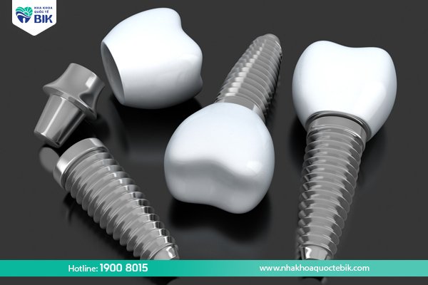 tuoi-tho-rang-implant