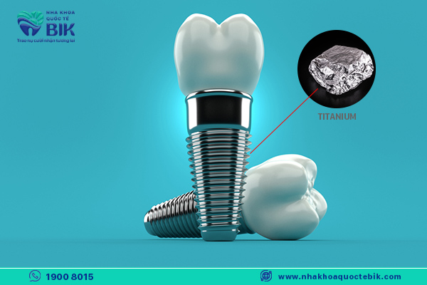 chất liệu titanium là trụ implant rất bền