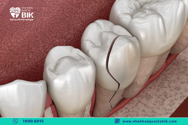 subjects suitable for cosmetic porcelain crowns