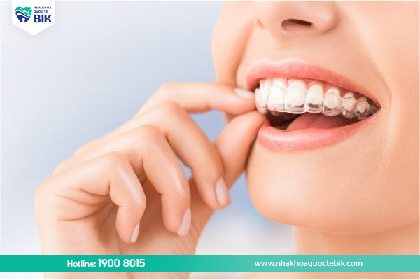 Advantages of braces without brackets