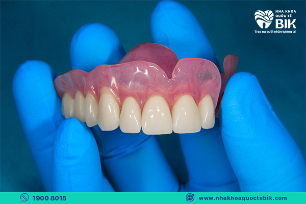 advantages of removable dentures