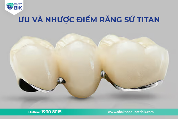 Ưu và nhược điểm của răng sứ titan